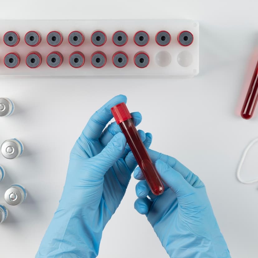 Blood Tests